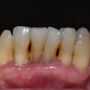 바름치과기공소 이미지