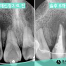 박진우치과의원 네이버블로그