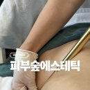 에너지케이 | 창원피부관리 피부숲 에스테틱 에너지테라피 복부관리 후기