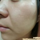 오로쉐 미백 주름개선앰플 기능성화장품 셀리뉴 사용후기