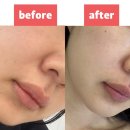 다은 | 서울대입구 리프팅 에스테틱 다은 내돈내산 솔직 후기