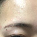 에스에이치 코스메틱 그룹 | 피부재생크림, 메디쥬얼리 시카플러스크림 좁쌀 완화 솔직 후기