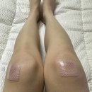 새로운약국 | 제왕절개 흉터제거 밴드로 새로운 약국 시카밴드, 스카엔틱 시카케어 사용후기