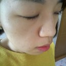 [아크네] 여드름비비크림, 지성피부BB 솔직후기