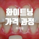 연세돌담치과의원 네이버블로그