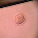 하양추어탕 | [전주시험관] 솔빛산부인과 시험관 신선2차 비임신 종결, 전원 결심