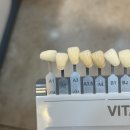 미소인치과의원 | 예신관리 강남 치아미백 비용 및 솔직 후기