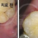 즐거운치과기공소 이미지