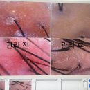 아이빗PC방 | 출산후 탈모에 대구두피관리 샵 멋진인생 에스테틱 두피센터 황금점