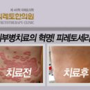 아이비컴 Daum카페