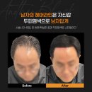 어나더블랙