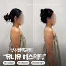 테라176 | 부산팔뚝관리 유니유에스테틱에서 1회차 테라노바관리 후기
