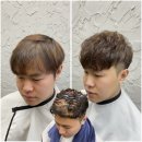 정자동밀도 | 정자동 탈모 증모술 후기 부분가발 없이 정수리 커버 가능할까