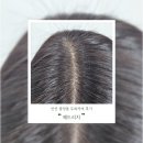 안산탈모 중앙동 두피커버 ❛헤드리치❜ 후기