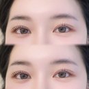 스마일브로우