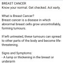 Breast cancer 이미지