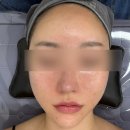 초이스뷰티라인 - 강남구 선릉로 431 | 구래동피부관리 초이스뷰티 / 모공에 효과좋은 관리 후기