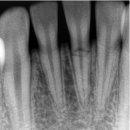 이(e)-밝은치과의원 이미지