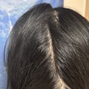 메시엘) 두피 에센스 내돈내산 후기 [맥주효모 토닉 세럼 쿨링 약산성 진정 비듬 헤어영양제 추천]