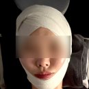 [대전/갈마역] 애드에스테틱, 비대칭+중안부 고민 해결✨ 연예인 경락 내돈내산 솔직 후기