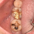 첫번째치과의원 이미지