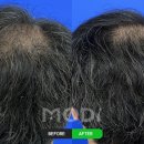 모디헤어플란트의원 이미지