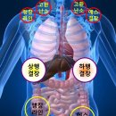 패스트푸드를 먹으면 가장 먼저 막히는 곳~맹장 이미지