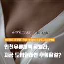 KT&G북인천지사 | 인천유륜미백 르멜라, 고객이 먼저 묻는 요즘 시술은 이것!