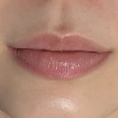 건대주변 | 건대 피부과 [브이로 리프팅] 주변에서 예뻐졌다고 100번 들은 레전드 후기