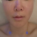 야당역 2번출구 | [연에스테틱] 야당역 2번 출구 바로 앞, 수기 동안윤곽관리 받고 왔어요✨