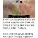 "속는 셈 치고 따라 했는데 정말 감쪽같이 사라졌어요" 집에 다 있는 이것으로 검버섯 말끔하게 제거하는 꿀팁 방법 이미지