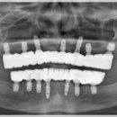 이다운치과기공소 이미지
