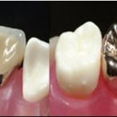 이노치과기공소 이미지