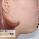 연세미소담은치과 이미지