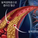 섹칼슘