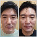명현네슈퍼 | 르시즈 멀티액션 리페어샷 후기｜리쥬란 쥬베룩 핵심 성분으로 집에서도 피부과급 홈케어