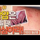 현대인이 가장 많이 아프다는 간! 한 눈에 알아보는 간암 초기 증상은 무엇? MBN 170411 방송 이미지