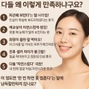🌟아이링 시술 효과 후기 총정리! 다들 왜 이렇게 만족하냐구요?