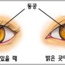아이피아 안경콘텍트 네이버블로그