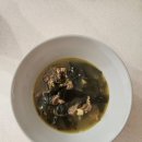 강남차병원 난소혹(기형종) 로봇수술 후기