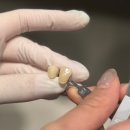 이바른치과기공소 이미지