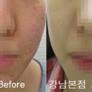 리유한의원 네이버블로그