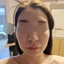 GS25 하신번영로점 | 사하구 마사지 에스테틱 관리 신평마사지 추천 : 이정은 스킨앤바디