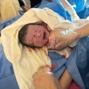 31140-5-41-9 | [둘째 자연분만 후기] 무통 없이 출산한 41주 경산모, 회복 과정과 병원 입원 비용 정리