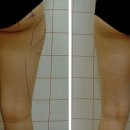닥터정앤박날씬의원