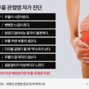 왼쪽 무릎통증 원인 증상 치료 무릎퇴행성 관절염 도수치료 프롤로주사 이미지