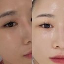 미더베스트 네이버블로그