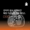 가성메디칼 네이버블로그