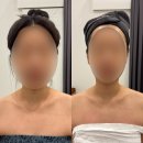 분당정자3-D-1 | 분당 정자역 에스테틱 추천 / 예신관리 승모근통증집중 테라피 : 에스테틱다리아 분당정자점