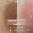 세이유네일 | 천안 쌍용동 어두워진 유륜 미백 케어 르멜라 세이유네일